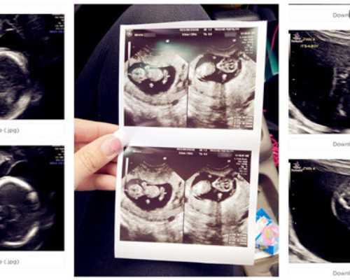 国内代生子,九价疫苗三个月后怀孕没问题吗